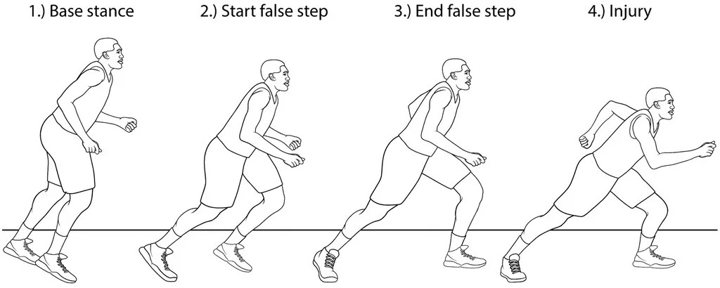 Схема руху «false step» і навантаження на ахіллове сухожилля (Journal of Applied Biomechanics)